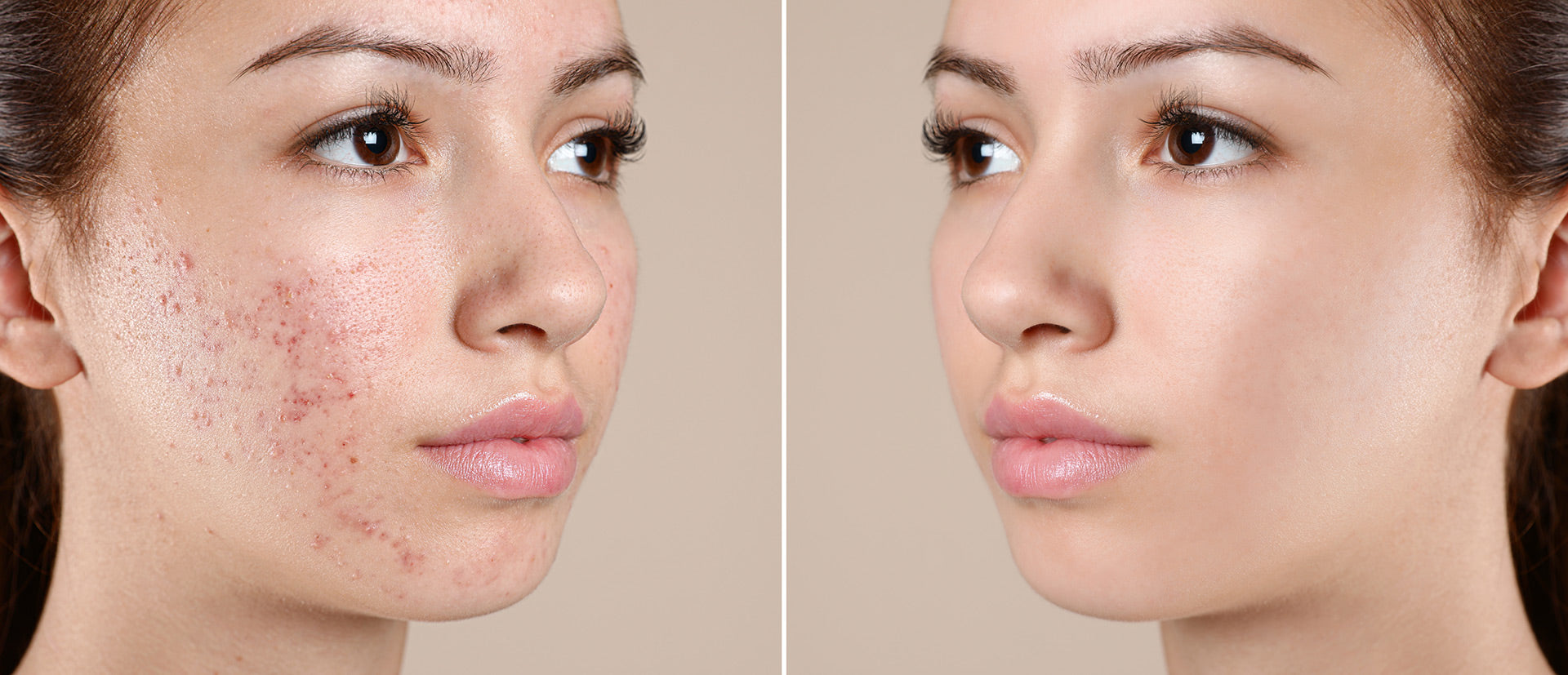 Reveal Your Radiance: Embrace Youthful Confidence!